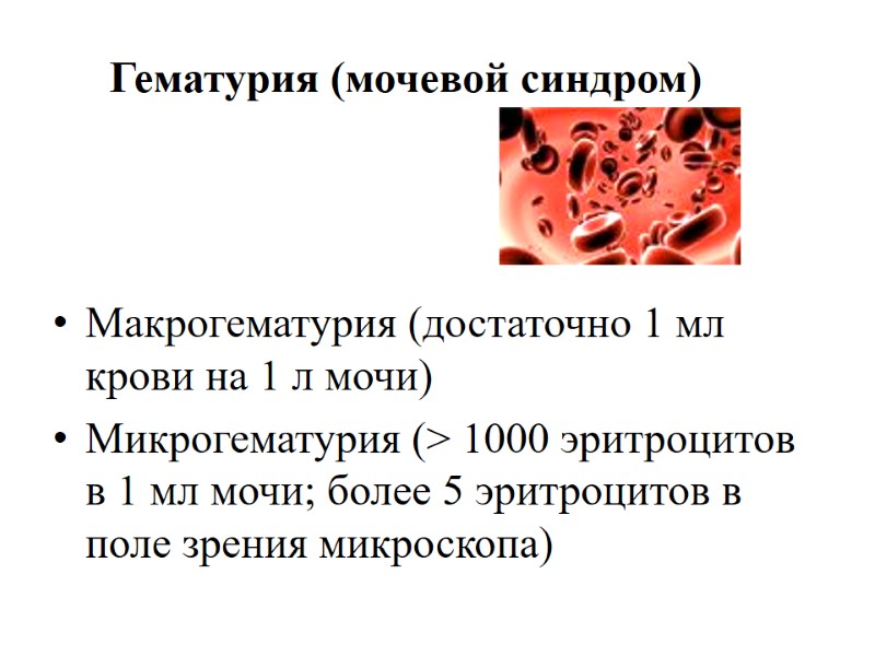 Гематурия (мочевой синдром)    Макрогематурия (достаточно 1 мл крови на 1 л